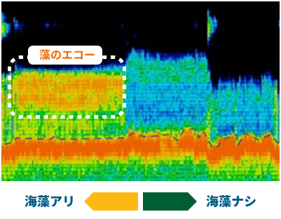 エコー画像